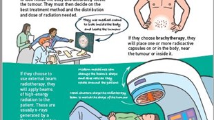 Treating cancer with radiation poster