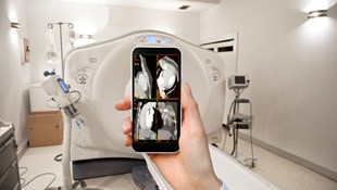 Diagnostic Radiology and Radiation Protection