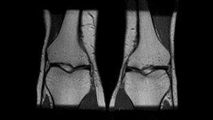 MRI Protocol Development: Clinical Optimisation and Standardisation