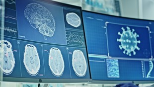 The 11th International Meeting on Cerebral Haemodynamic Regulation (CARNet)
