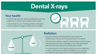 CIB dental x-rays