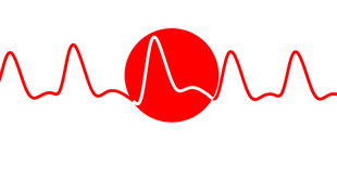 WEBINAR: Developments in Photoplethysmography