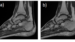 Case Study 1: Multi-Slice in Musculo-Skeletal MR on Siemens Sola (XA31)