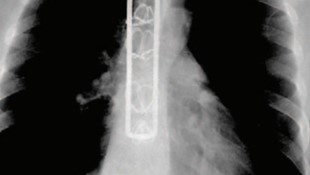 Rad Magazine Publication