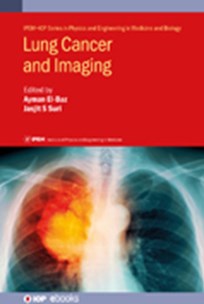 Cover of Lung Cancer and Imaging