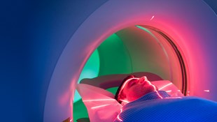 Magnetic Resonance Image Guided Radiotherapy