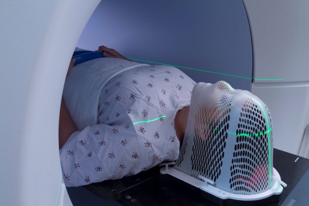 IPEM responds to Guardian article on AI in radiotherapy
