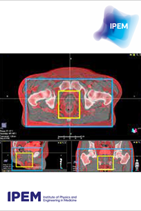 Cover of Topical Report - Guidance on the use of MRI for external beam radiotherapy treatment planning