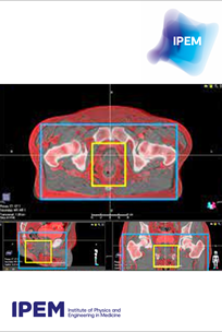 Cover of Topical Report - Guidance on the use of MRI for external beam radiotherapy treatment planning 